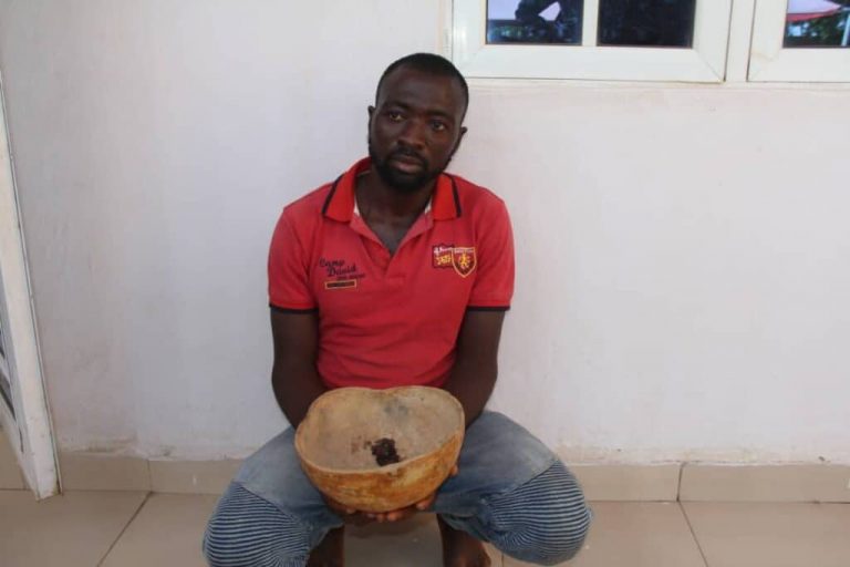 Police recover plucked eyes of 16-year-old boy after arresting 3 suspects