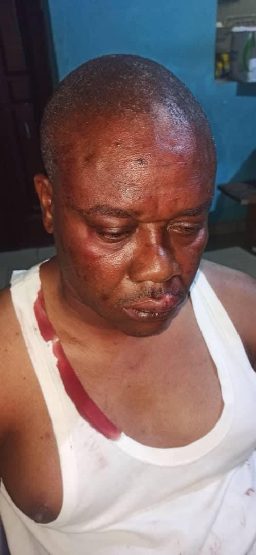 PDP and APC supporters clash, one injured at Twon Brass